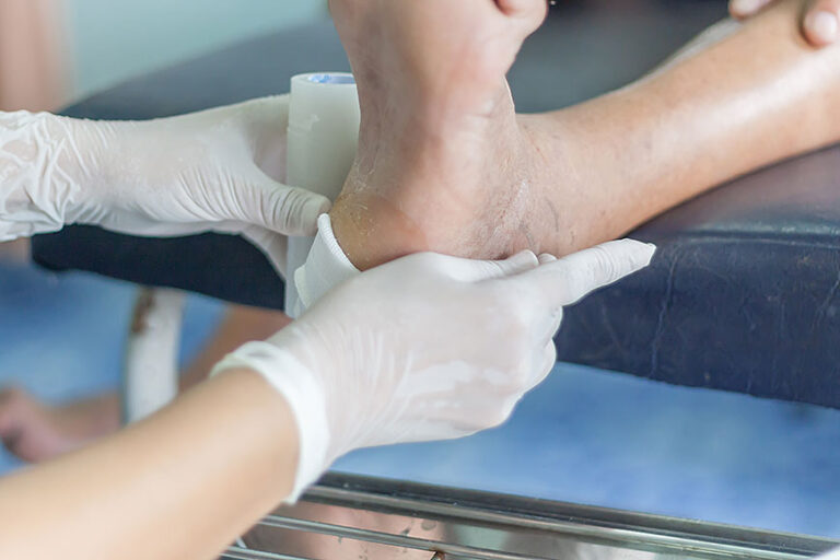 Diabetic Foot Ulcer New Hope Podiatry Group Los Angeles